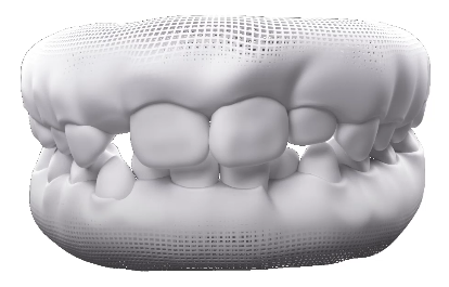 Dientes Mixtos